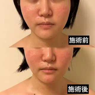 WOM SALON所属・MIKU【美容整形ダ ウンタイムケア銀座】のエステ・リラクイメージ