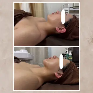 Total Beauty Salon Vi's CLUB by BINEL所属・Vi's CLUB KOTONOのエステ・リラクイメージ