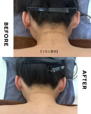 キッズ 💠mariange💠(脱毛・ハーブピーリング)所属・mariange 〜美肌・美容脱毛〜のエステ・リラクイメージ