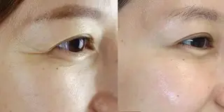 マツエク・マツパ aliaハイフ&水光ジェットサロン所属・aliaハーブ水光店 エステティシャン募集のエステ・リラクイメージ