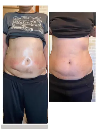 ミリ ミリのエステ・リラクイメージ