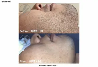 メンズ noel de mi 前川亜里沙のエステ・リラクイメージ