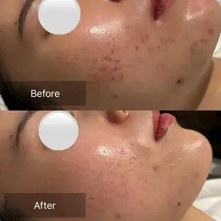 【美肌・脱毛専門店】 SARA 恵比寿店のエステ・リラクイメージ