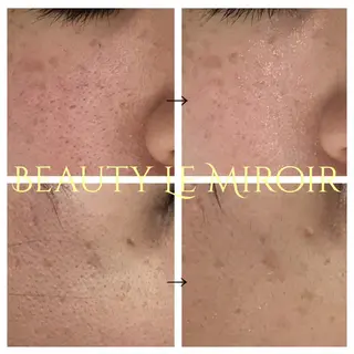 ビューティー ミロワールのエステ・リラクイメージ