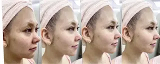 MARIRE EPISALONのエステ・リラクイメージ