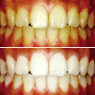 WhiteningSquare by Avanti所属・ホワイトニングスクエ ア by アバンティのその他イメージ