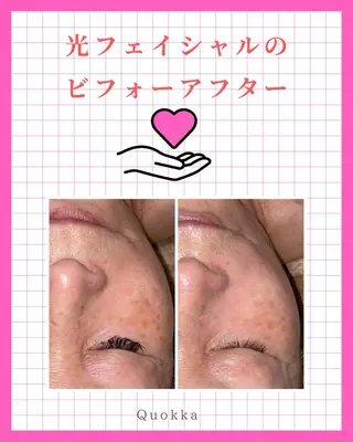 Quokka ✴︎ あま市甚目寺のエステ・リラクイメージ