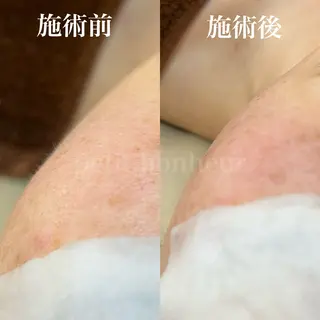 槙谷 あさみのエステ・リラクイメージ