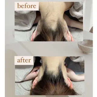 crescent所属・【韓国肌管理・脱毛】 クレセントのその他イメージ