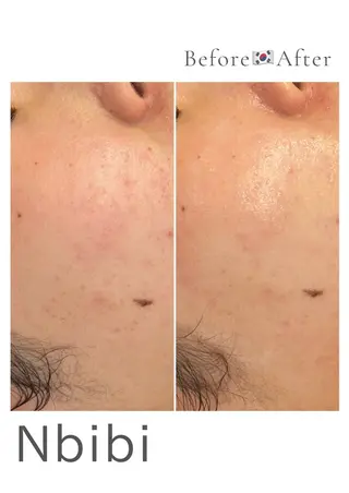 韓国🇰🇷価格 サロン_Nbibiのエステ・リラクイメージ