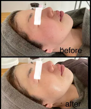 Lavi&所属・肌質改善サロン Lavi&のその他イメージ