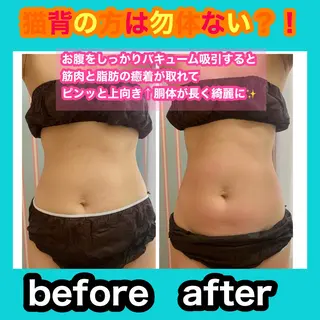 痩身/脱毛/ネイル HARUKAのエステ・リラクイメージ