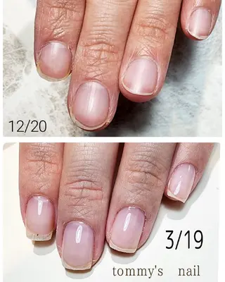 ネイル tommy's nail所属・福岡/若よもぎ蒸し 全身美容が叶うサロンのネイルデザイン