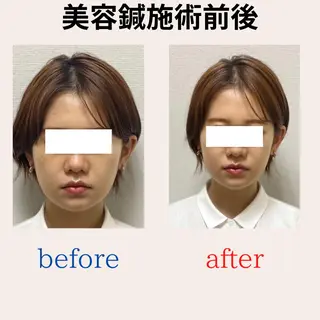 BEAUTY&HEALTH鍼灸院【春日部筋膜整体タケダ整体院】所属・武田 紘輝のエステ・リラクイメージ