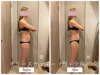 ブライダルサロン ｜Lino【堀江】のエステ・リラクイメージ