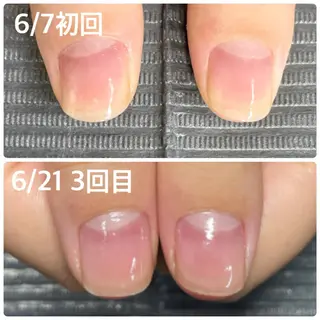 ネイル 奥園 良恵のネイルデザイン