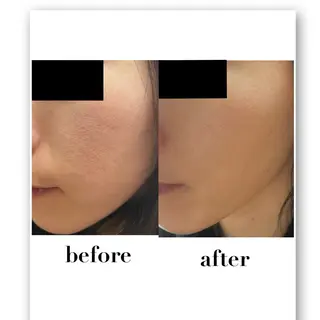 デ・アイム吹田サロン所属・垣内 賀奈子のエステ・リラクイメージ