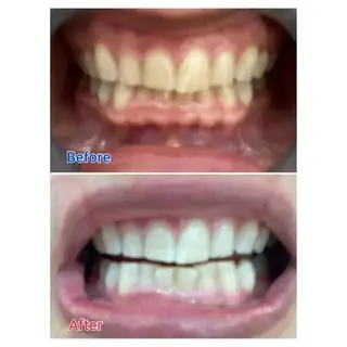 M渋谷店所属・M渋谷 ホワイトニングのエステ・リラクイメージ