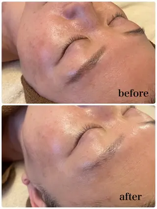 調律エステ /美KISSのその他イメージ