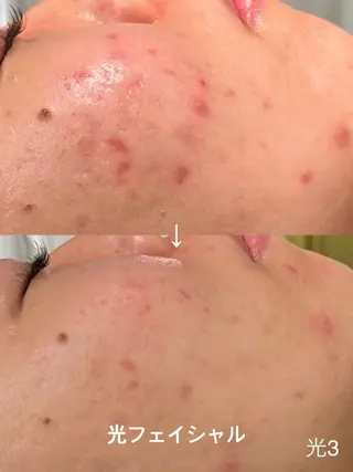 LEPUS【レプス】 sekiのエステ・リラクイメージ