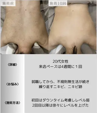 脱毛・眉毛・フェイス サロンN久留米店の眉毛・アイブロウイメージ