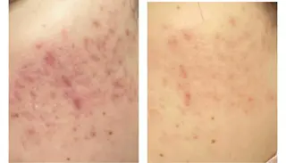 セミロング カラー パーマ ヘアアレンジ メンズ キッズ ネイル マツエク・マツパ アイブロウ ニキビ特化型エステ 🍓最短で肌質改善のエステ・リラクイメージ