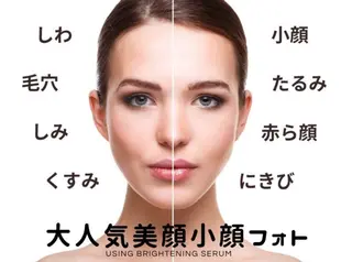 脱毛サロン　HUGME.所属・脱毛サロンHUGME 光フォトフェイシャルのエステ・リラクイメージ