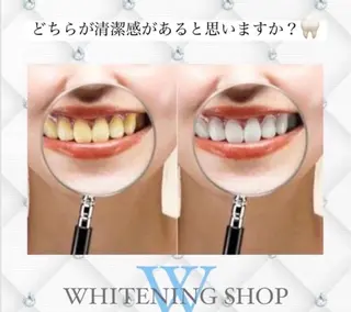 メンズ ホワイトニング ショップ船橋店🦷のエステ・リラクイメージ