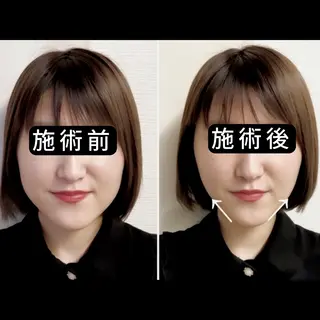 渋谷 小顔美容鍼 専門サロン YZのエステ・リラクイメージ