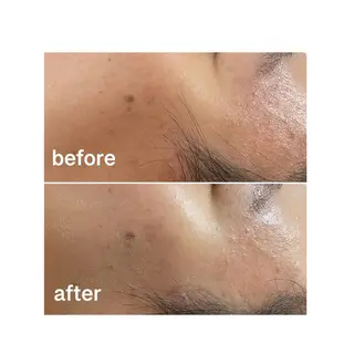 アロマ•ピーリング SalonYokoのその他イメージ