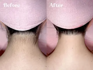 脱毛サロンTTe もものエステ・リラクイメージ