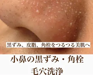 アンテインチル 山本のエステ・リラクイメージ