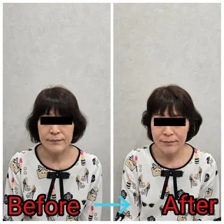 小顔矯正・美容鍼 FLOW鍼灸整体院のエステ・リラクイメージ