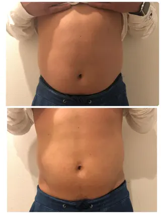 体の中から肌質改善 クレール 奈良のエステ・リラクイメージ