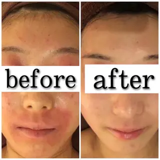 セミロング カラー パーマ ヘアアレンジ メンズ キッズ ネイル マツエク・マツパ アイブロウ ニキビ特化型エステ 🍓最短で肌質改善のエステ・リラクイメージ