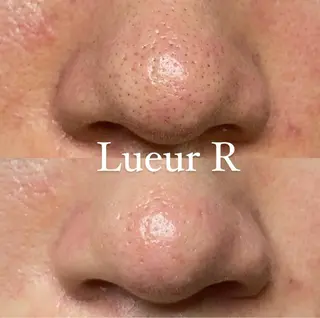 大久保 里奈のエステ・リラクイメージ