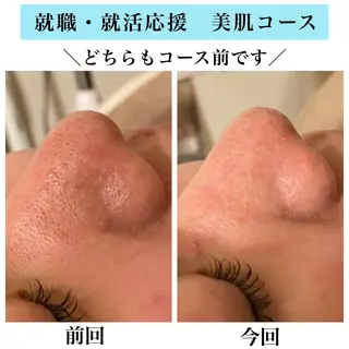 Bellesthe （ベルエステ）のエステ・リラクイメージ