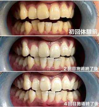 ホワイトニング専門店 Hi-Whiteのその他イメージ