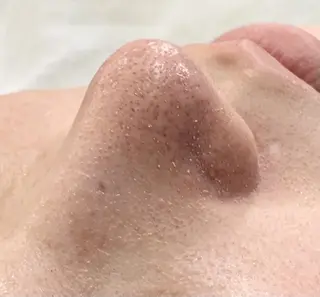 毛穴美人・小顔美人へ サロントルチュのエステ・リラクイメージ