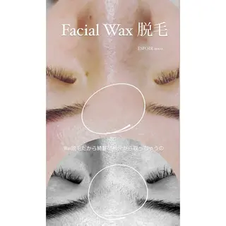ワックス脱毛🌈 ESPOIRnocoのエステ・リラクイメージ