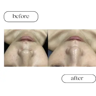 美肌専門サロン RUBONのエステ・リラクイメージ