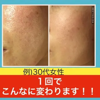 ショート カラー パーマ ヘアアレンジ メンズ キッズ ネイル マツエク・マツパ ニキビ・肌質改善専門 ♡人生が変わるサロンのエステ・リラクイメージ