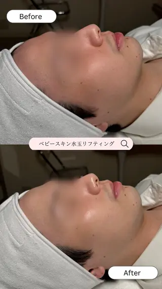 韓国肌管理🫧LDM 🫧Junnaのエステ・リラクイメージ