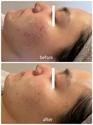 エステティックジュビラン アンビエンテ福井南店所属・坂下 智恵のエステ・リラクイメージ