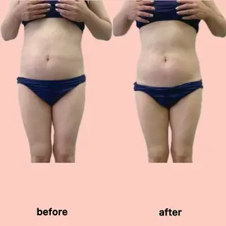 gleam ü 枚方公園のエステ・リラクイメージ