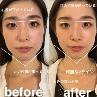 美容鍼灸サロン mahoroba院長のエステ・リラクイメージ