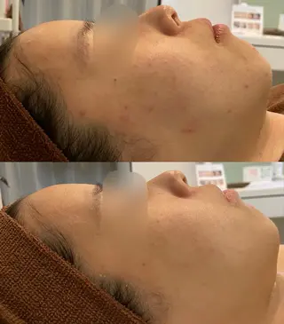 ハーブピーリング専門 BIOPLUS＋川崎のエステ・リラクイメージ