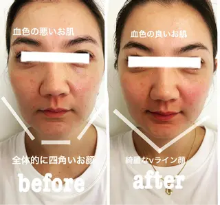 美容鍼灸サロン mahoroba院長のエステ・リラクイメージ