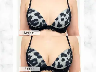 バストアップサロン Lulumiliのエステ・リラクイメージ