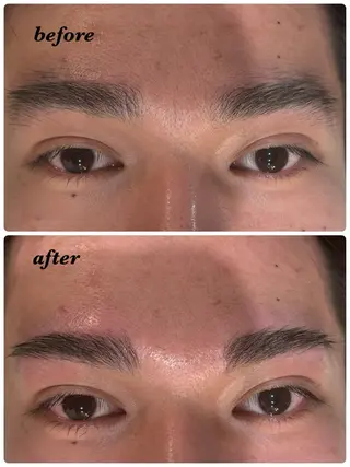 メンズ アイブロウ ハーブピーリング/韓国肌管理/フェイシャル/毛穴洗浄/眉毛/顔脱毛【糸脱毛専門】rev所属・ハーブピーリング🌹 毛穴洗浄❤️眉waxのエステ・リラクイメージ